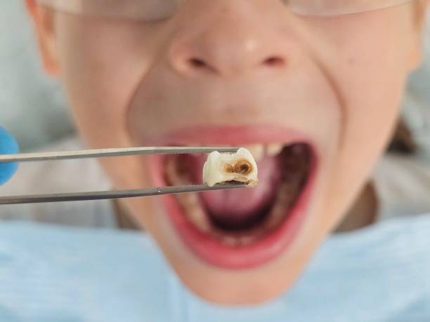 Best Emergency Orthodontic Repairs in Highland, KS